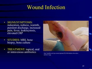 Wound Infection
• SIGNS/SYMPTOMS:
induration, redness, warmth,
purulent discharge, increased
pain, fever, leukocytosis,
elevated CRP
• STUDIES: MRI, bone
biopsy, bone culture
• TREATMENT: topical, oral
or intravenous antibiotics
25
http://healthh.com/wp-content/uploads/2014/06/diabetic-foot-ulcer-
pictures-3.jpg
 