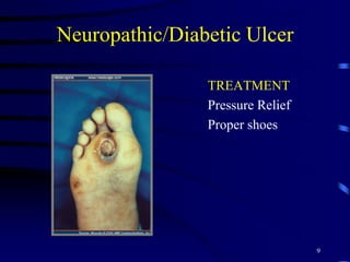 Neuropathic/Diabetic Ulcer
TREATMENT
Pressure Relief
Proper shoes
9
 