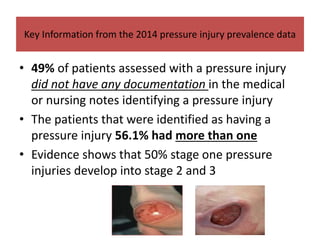 Key Information from the 2014 pressure injury prevalence data
• 49% of patients assessed with a pressure injury
did not have any documentation in the medical
or nursing notes identifying a pressure injury
• The patients that were identified as having a
pressure injury 56.1% had more than one
• Evidence shows that 50% stage one pressure
injuries develop into stage 2 and 3
 