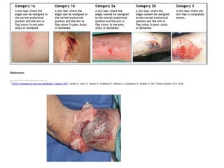 Identification of Risk of Injury
 