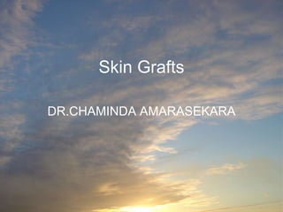 Skin Grafts
DR.CHAMINDA AMARASEKARA
 