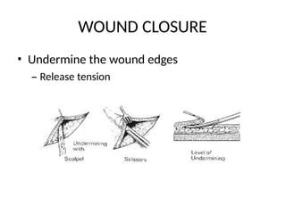 Comprehensive Guide to Wound Healing and Care Management | PPTX