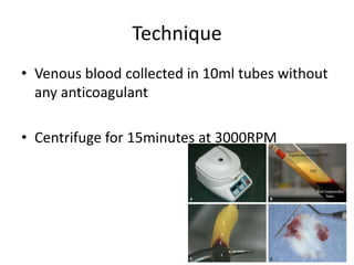 Technique
• Venous blood collected in 10ml tubes without
any anticoagulant
• Centrifuge for 15minutes at 3000RPM
 