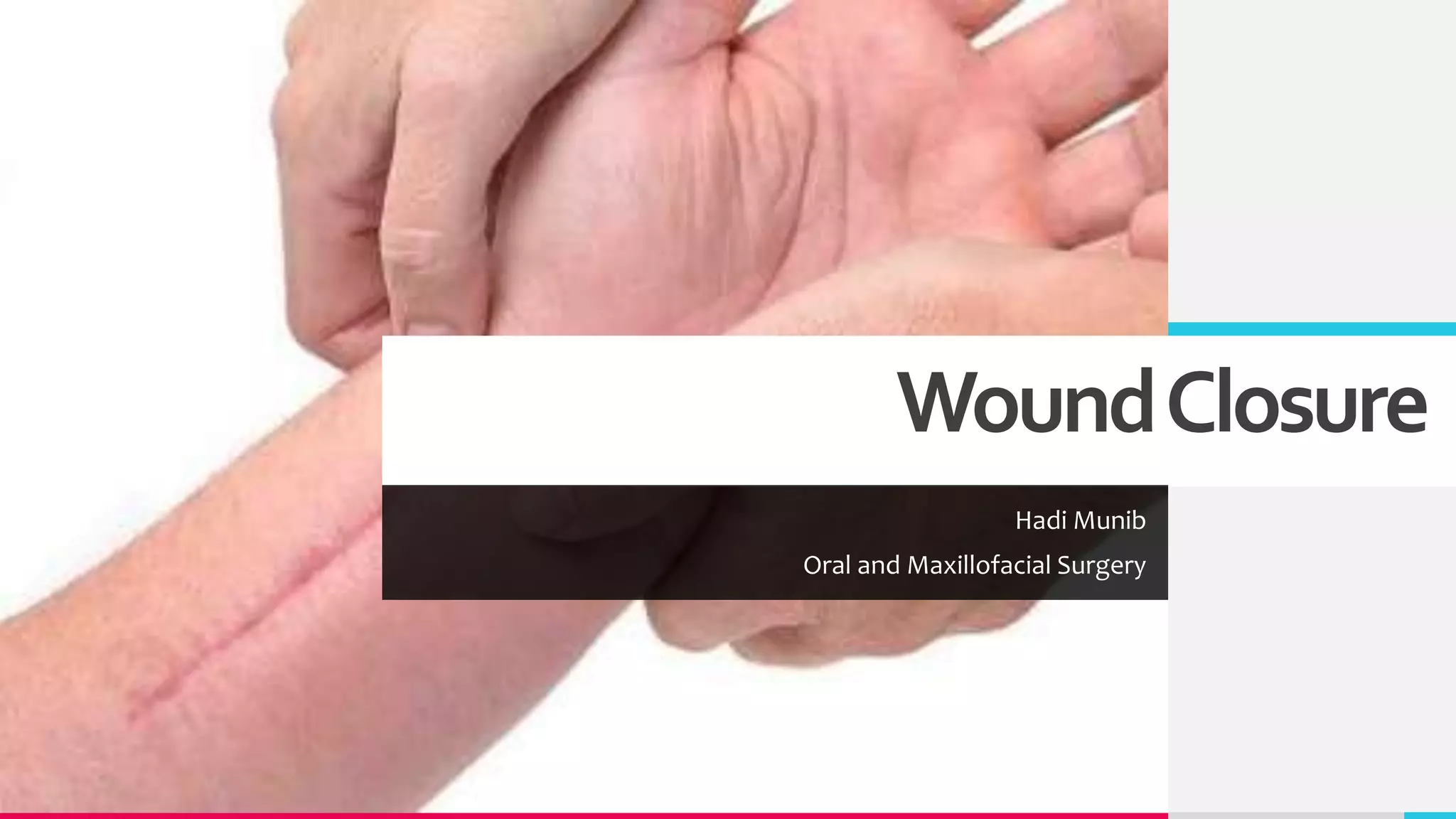Suturing and Wound Closure | PPTX