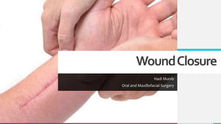 WoundClosure
Hadi Munib
Oral and Maxillofacial Surgery
 