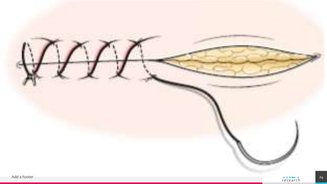 Suturing and Wound Closure | PPTX | First Aid | Injuries