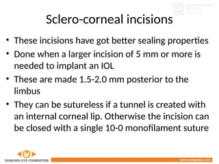 Comprehensive Guide to Wound Construction in Cataract Surgery for ...