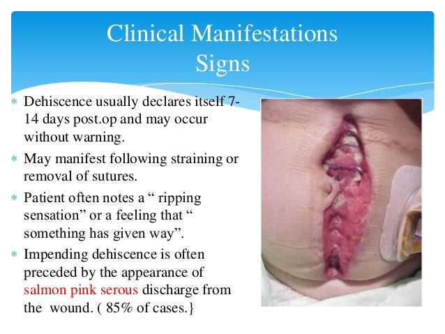 how treat patient to fever WOUND DEHISCENCE