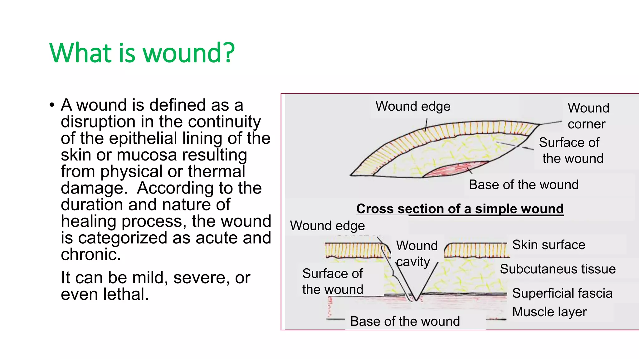 wound-dressing-ppt-free-download