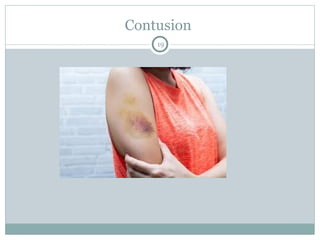 wound and wound healinh for the medical students | PPT