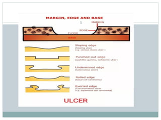 wound and wound healinh for the medical students | PPT