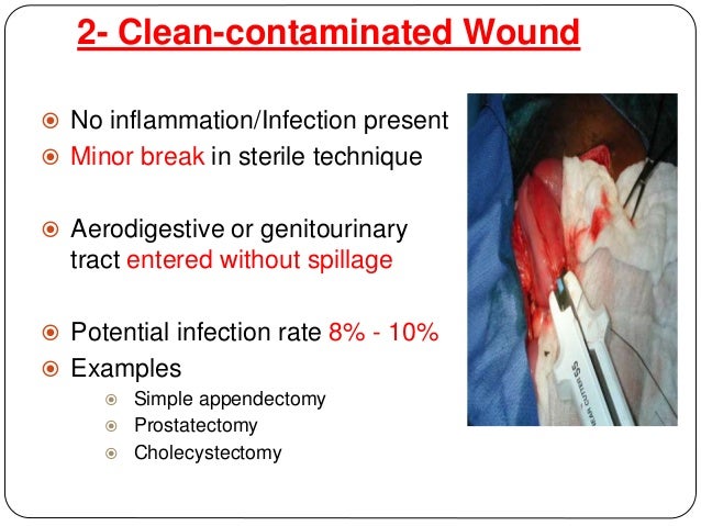 cleaning wounds wound for c i cleaning wounds wound for c i