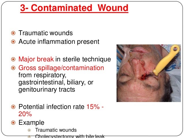 how to clean an infected wound on a wound for c i how to clean an infected wound on a wound for c i