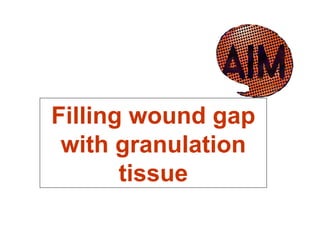 Filling wound gap with granulation tissue 