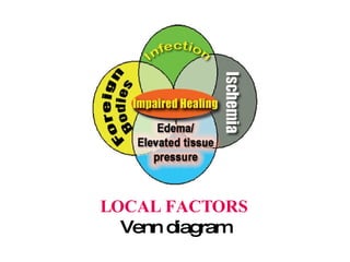 LOCAL FACTORS Venn diagram 