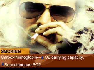 SMOKING Carboxihemoglobin---  O2 carrying capacity.  Subcutaneous PO2  
