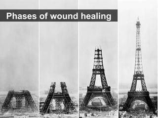 Phases of wound healing 