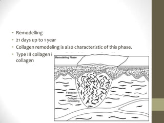 Remodelling21 days up to 1 yearCollagen remodeling is also characteristic of this phase.Type III collagen is initially laid down, replaced by type I collagen