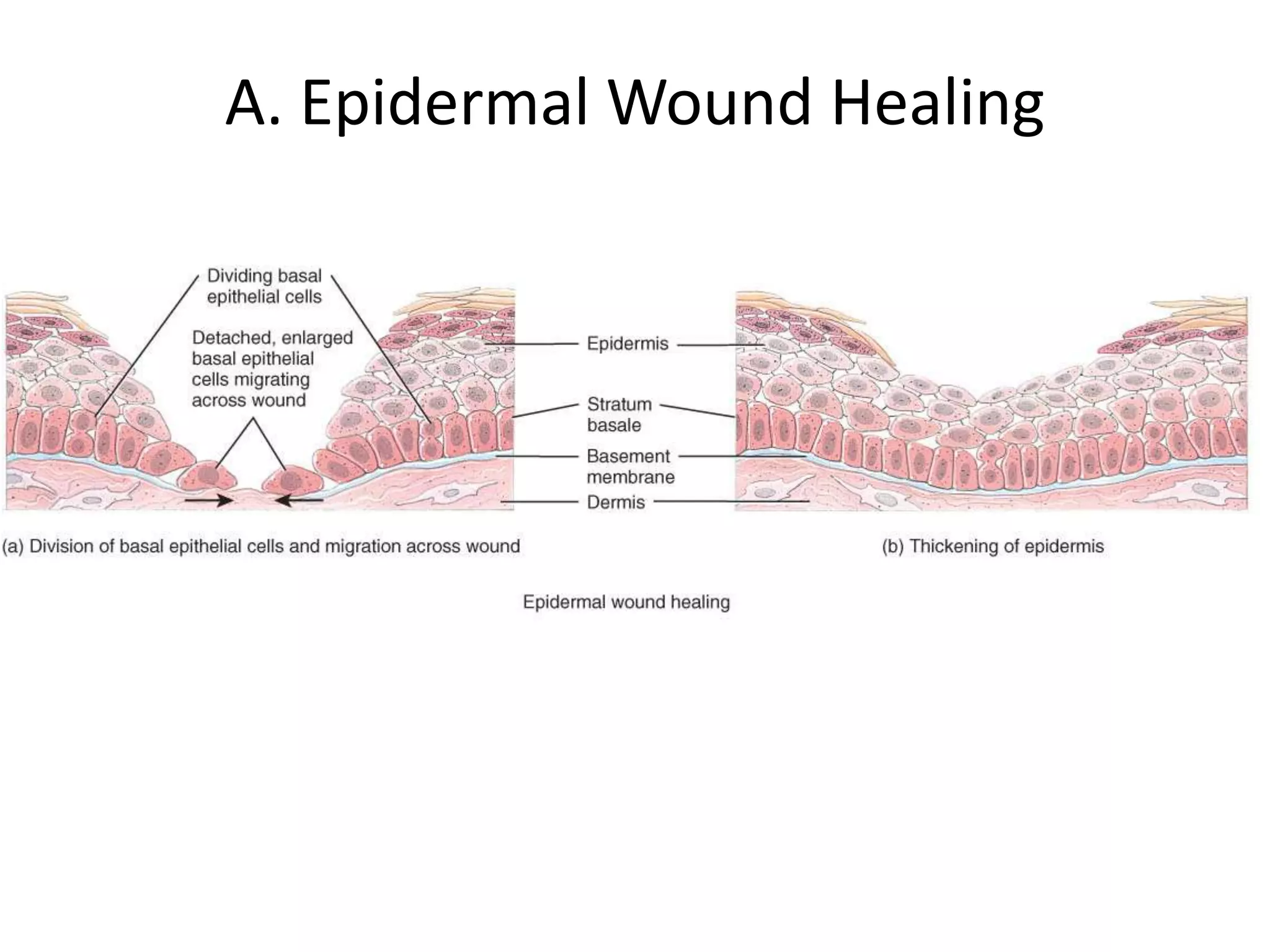 Wound healing | PPTX