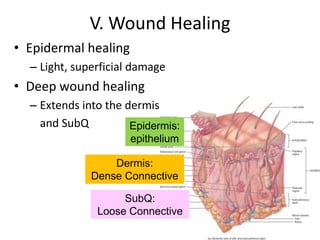 V. Wound Healing Epidermal healing Light, superficial damage Deep wound healing Extends into the dermis 	and SubQ Epidermis:  epithelium Dermis:  Dense Connective SubQ:  Loose Connective 
