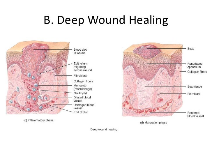 Body Diagram Wound Healing
