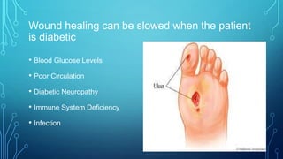Wound healing can be slowed when the patient
is diabetic
• Blood Glucose Levels
• Poor Circulation
• Diabetic Neuropathy
•...