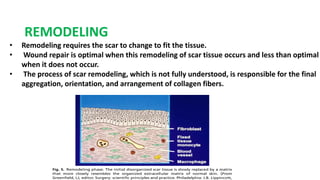 REMODELING
• Remodeling requires the scar to change to fit the tissue.
• Wound repair is optimal when this remodeling of scar tissue occurs and less than optimal
when it does not occur.
• The process of scar remodeling, which is not fully understood, is responsible for the final
aggregation, orientation, and arrangement of collagen fibers.
 
