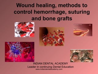 Wound healing, methods to
control hemorrhage, suturing
and bone grafts
INDIAN DENTAL ACADEMY
Leader in continuing Dental Education
www.indiandentalacademy.com
 