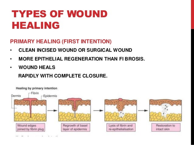 Wound healing