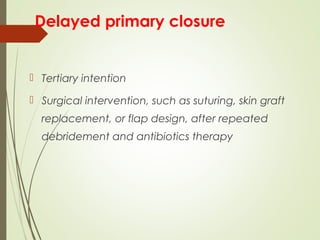 Delayed primary closure
 Tertiary intention
 Surgical intervention, such as suturing, skin graft
replacement, or flap design, after repeated
debridement and antibiotics therapy
 