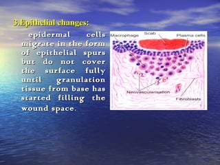 Wound healing | PPT