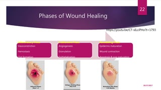 Phases of Wound Healing
Inflammatory Phase
Vasoconstriction
Hemostasis
Clot formation
Proliferative Phase
Angiogenesis
Granulation
Epithelialization
Remodeling Phase
Epidermis maturation
Wound contraction
Apoptosis & scar maturation
10/27/2017
22
https://youtu.be/CT-xILciPHo?t=1793
 