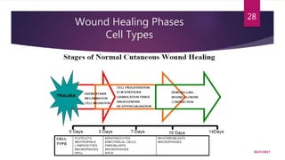 Wound Healing Phases
Cell Types
10/27/2017
28
 