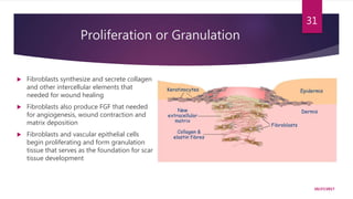 Proliferation or Granulation
10/27/2017
31
 Fibroblasts synthesize and secrete collagen
and other intercellular elements that
needed for wound healing
 Fibroblasts also produce FGF that needed
for angiogenesis, wound contraction and
matrix deposition
 Fibroblasts and vascular epithelial cells
begin proliferating and form granulation
tissue that serves as the foundation for scar
tissue development
 