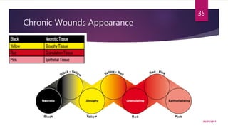 Chronic Wounds Appearance
10/27/2017
35
 