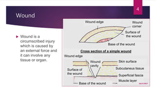 Wound
 Wound is a
circumscribed injury
which is caused by
an external force and
it can involve any
tissue or organ.
Wound edge Wound
corner
Surface of
the wound
Base of the wound
Cross section of a simple wound
Skin surface
Subcutaneus tissue
Superficial fascia
Muscle layer
Base of the wound
Wound edge
Surface of
the wound
Wound
cavity
10/27/2017
4
 