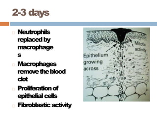 2-3 days
Neutrophils
replacedby
macrophage
s
Macrophages
removetheblood
clot
Proliferationof
epithelialcells
Fibroblasticactivity
 