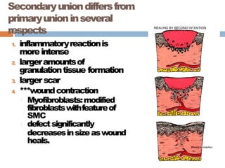 Secondaryuniondiffersfrom
primaryunioninseveral
respects
1
. inflammatoryreactionis
moreintense
2. largeramountsof
granulationtissue formation
3. larger scar
4
. ***woundcontraction
Myofibroblasts:modified
fibroblastswithfeatureof
SMC
defectsignificantly
decreasesinsizeaswound
heals.
 