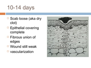 10-14 days
 Scab loose (aka dry
clot)
 Epithelial covering
complete
 Fibrous union of
edges
 Wound still weak
 vascularization
 