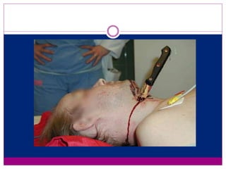 Puckered Incision Wound healing | PPTX