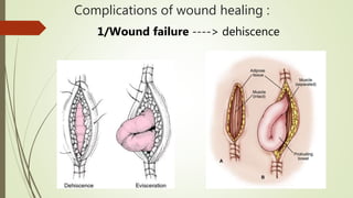 Complications of wound healing :
1/Wound failure ----> dehiscence
 