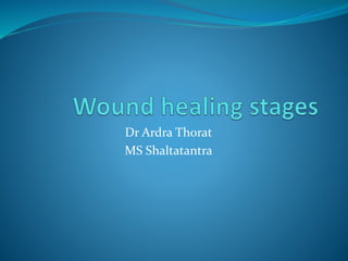 Dr Ardra Thorat
MS Shaltatantra
 