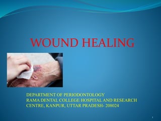 1
WOUND HEALING
DEPARTMENT OF PERIODONTOLOGY
RAMA DENTAL COLLEGE HOSPITALAND RESEARCH
CENTRE, KANPUR, UTTAR PRADESH- 208024
 