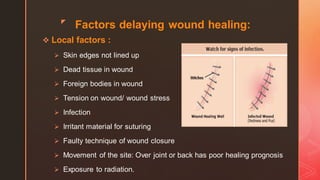 z
Factors delaying wound healing:
❖ Local factors :
➢ Skin edges not lined up
➢ Dead tissue in wound
➢ Foreign bodies in wound
➢ Tension on wound/ wound stress
➢ Infection
➢ Irritant material for suturing
➢ Faulty technique of wound closure
➢ Movement of the site: Over joint or back has poor healing prognosis
➢ Exposure to radiation.
 