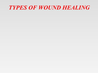 TYPES OF WOUND HEALING
 