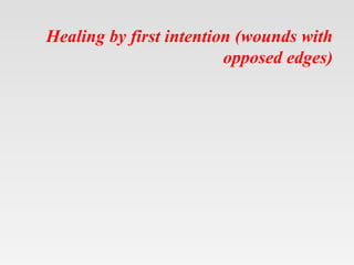 Healing by first intention (wounds with
opposed edges)
 