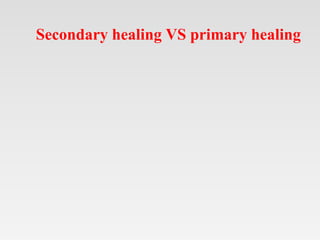 Secondary healing VS primary healing
 