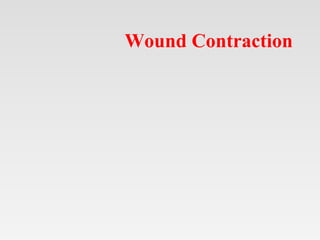 Wound Contraction
 
