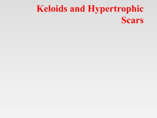 Keloids and Hypertrophic
Scars
 