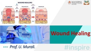 Prof. U. Murali.
Wound Healing
 